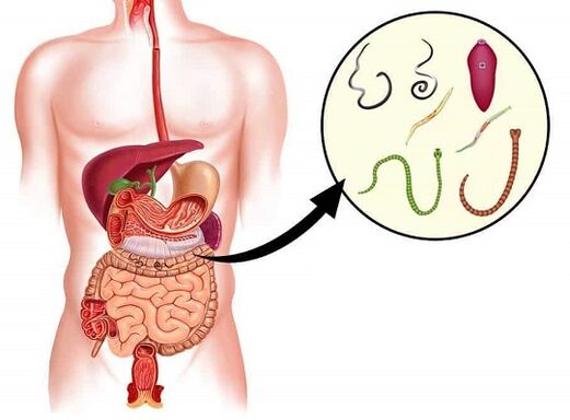 Nemanex se débarrasse des parasites