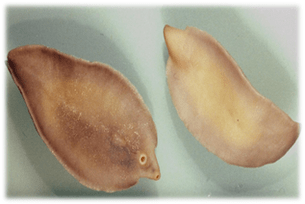 Fasciolose